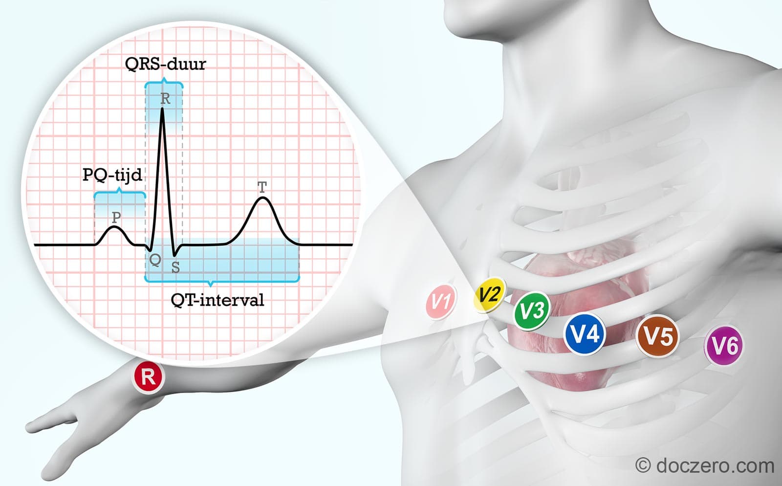 Cardiologie