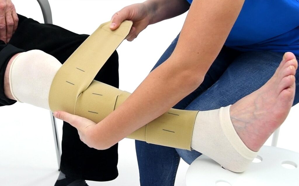 Zwachtelen onderbeen met Juxtalite