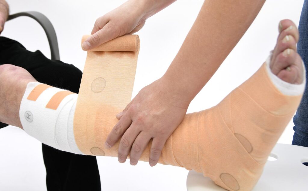 Zwachtelen onderbeen met UrgoK2