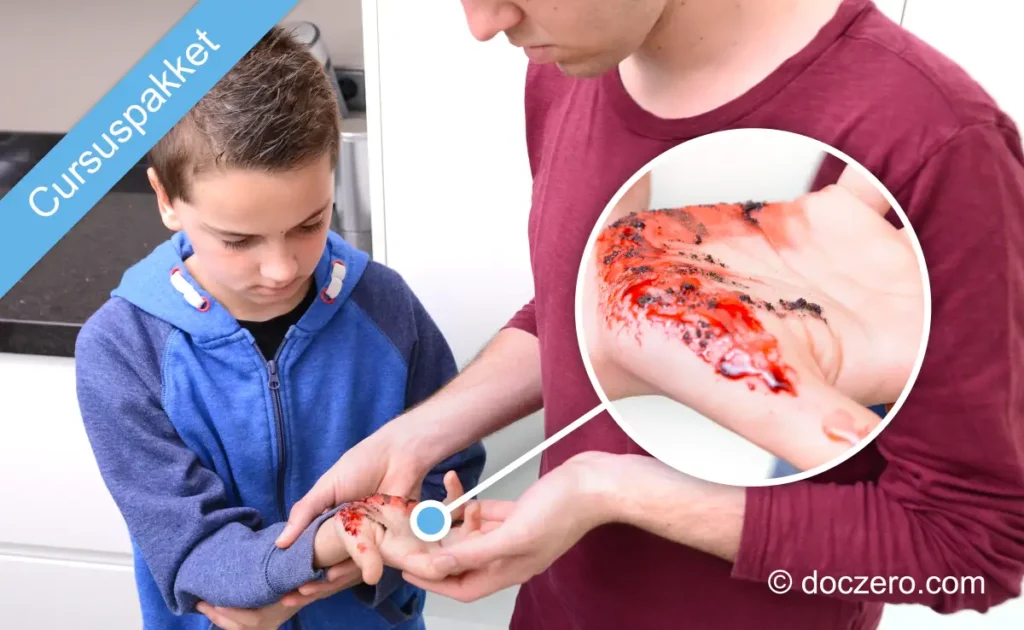E-learning voor EHBO, BHV en BLS opleiders | cursuspakket eerste hulp ehbo kinderen doczero incl | Doczero EHBO kinderen cursuspakket