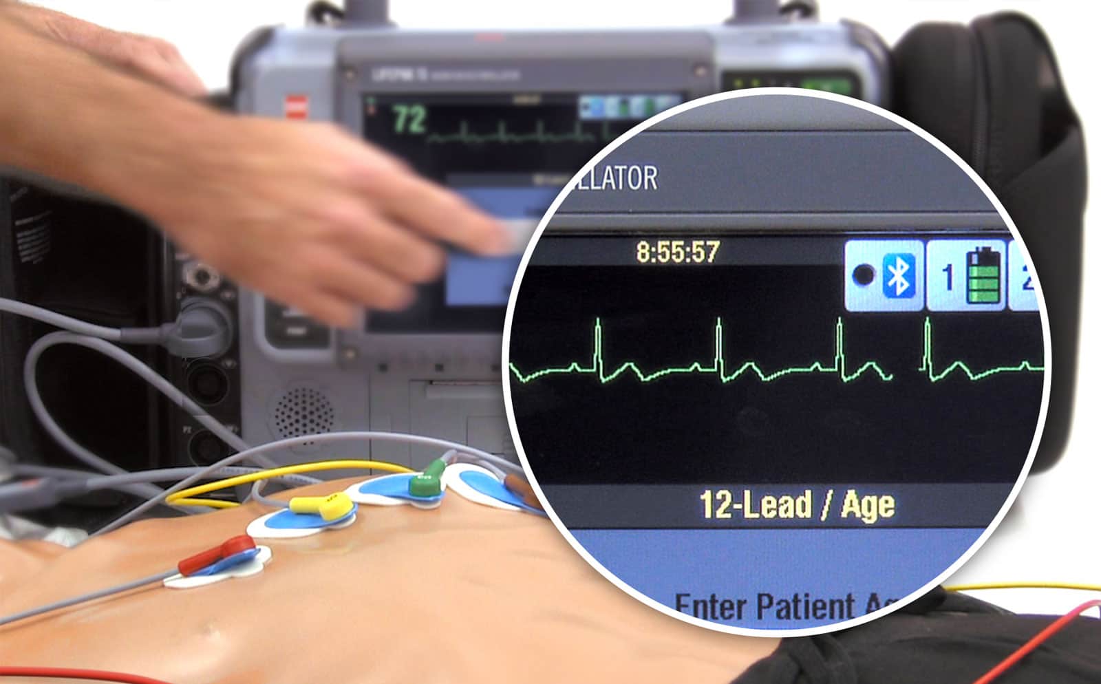 Monitor-Defibrillator hartritmebewaking