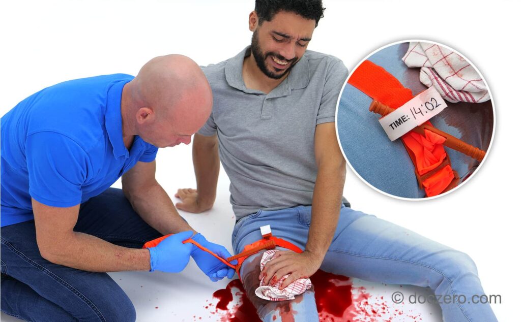 E-learning voor EHBO, BHV en BLS opleiders | tourniquet aanbrengen eerstehulpverlener ehbo bhv | Doczero Ontdek tourniquet aanbrengen eerstehulpverlener