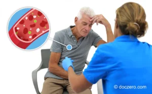 Diabetes e-learning Doczero, start vandaag