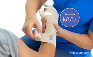 Zwachtelen arm met korte rekzwachtels