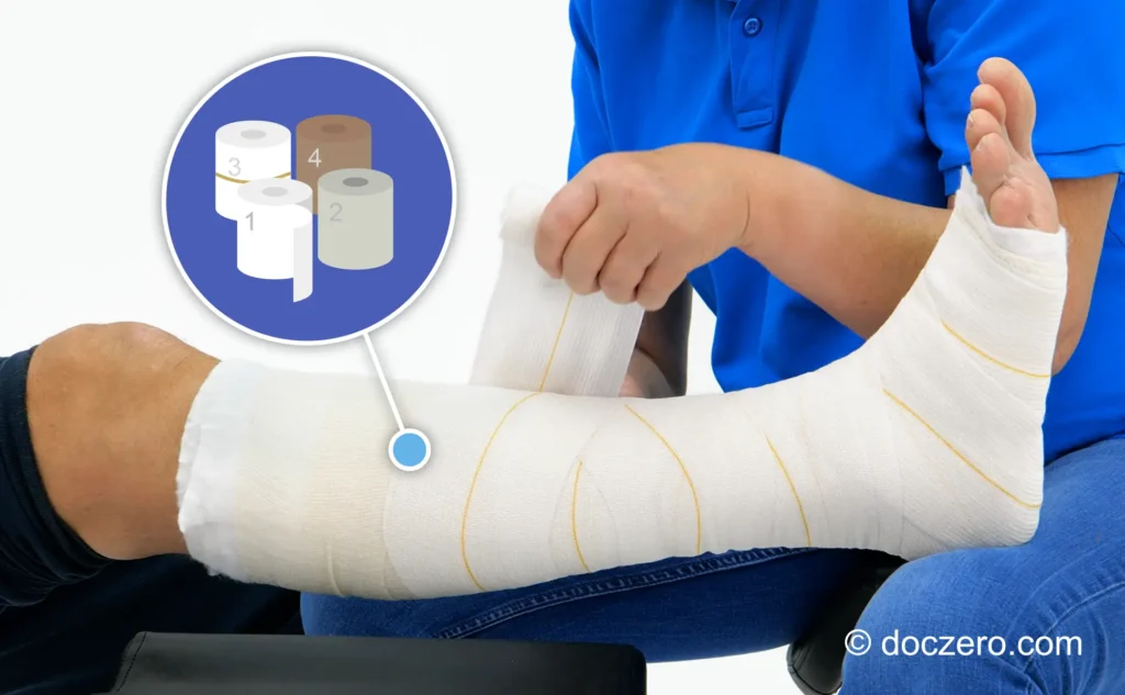 Zwachtelen onderbeen met Profore 4-laags zwachtelmethode