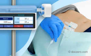 Medicatie toedienen met spuitenpomp via subcutaan infuus