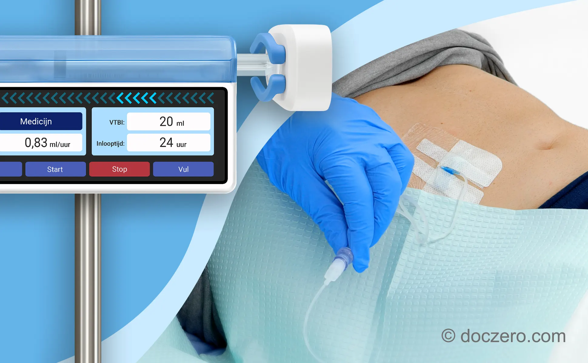 Medicatie toedienen met spuitenpomp via een subcutaan infuus