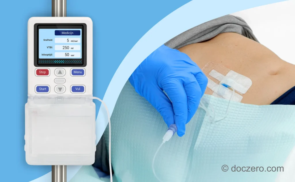 Medicatie toedienen met cassettepomp via een subcutaan infuus
